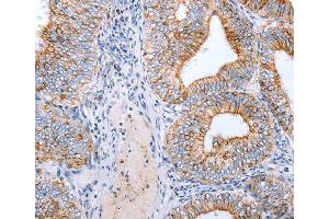 Immunohistochemistry (IHC) image for anti-Claudin 3 (CLDN3) antibody (ABIN3017040) (Claudin 3 antibody)