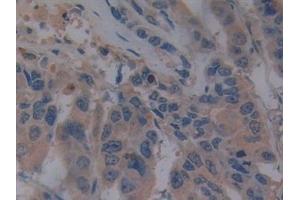 Immunohistochemistry (IHC) image for anti-Toll-Like Receptor 9 (TLR9) (AA 28-362) antibody (ABIN7432445)