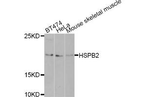 Western blot analysis of extracts of various cell lines, using HSPB2 antibody (ABIN5971309) at 1/1000 dilution. (HSPB2 antibody)