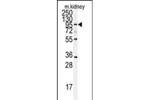 ADAM9 antibody  (N-Term)