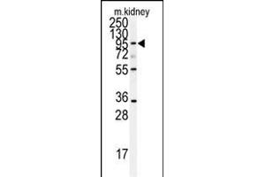 Western blot analysis of anti-AD Antibody (N-term) (ABIN391640 and ABIN2841551) in mouse kidney tissue lysates (35 μg/lane). (ADAM9 antibody  (N-Term))