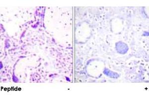 Immunohistochemical analysis of paraffin-embedded human placenta tissue using PPARG polyclonal antibody . (PPARG antibody  (Ser112))