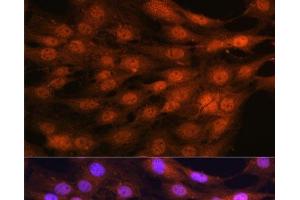 Immunofluorescence analysis of C6 cells using YAP1 Polyclonal Antibody at dilution of 1:100. (YAP1 antibody)