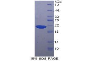 SDS-PAGE (SDS) image for Hornerin (HRNR) (AA 2685-2850) protein (His tag) (ABIN2125221) (HRNR Protein (AA 2685-2850) (His tag))