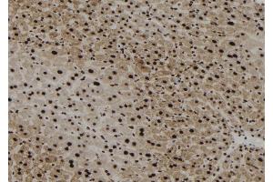 ABIN6256764 and ABIN6267179 at 1/100 staining Mouse liver tissue by IHC-P.