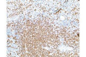 Immunohistochemistry (IHC) image for anti-CD3 epsilon (CD3E) (AA 139-189) antibody (ABIN7454000) (Recombinant CD3 epsilon antibody  (AA 139-189))