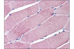 Human Skeletal Muscle: Formalin-Fixed, Paraffin-Embedded (FFPE) (TRIM7 antibody  (C-Term))