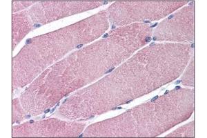 Human Skeletal Muscle: Formalin-Fixed, Paraffin-Embedded (FFPE) (TRIM7 antibody  (C-Term))