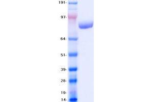 Western Blotting (WB) image for Valosin Containing Protein (VCP) protein (Myc-DYKDDDDK Tag) (ABIN2733427)
