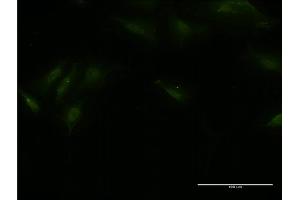 Immunofluorescence of monoclonal antibody to BTBD9 on HeLa cell. (BTBD9 antibody  (AA 2-70))