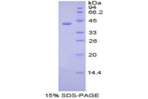SDS-PAGE (SDS) image for Cholecystokinin (CCK) (AA 1-115) protein (His tag,GST tag) (ABIN1821623)