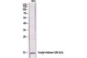 Western Blot (WB) analysis of specific cells using Acetyl-Histone H2B (K5) Polyclonal Antibody. (Histone H2B antibody  (acLys5))