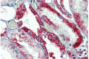 Kidney, Human: Formalin-Fixed, Paraffin-Embedded (FFPE) (Cytokeratin 18 antibody)