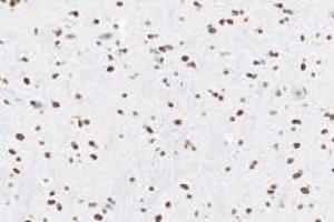 Immunohistochemistry analysis of paraffin-embedded rat substantia nigra using Ring1A (ABIN7075467) at dilution of 1: 3600 (RING1 antibody)