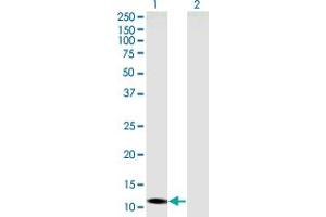 Western Blot analysis of SLC22A18AS expression in transfected 293T cell line by SLC22A18AS monoclonal antibody (M05), clone 4B1. (SLC22A18AS antibody  (AA 1-150))