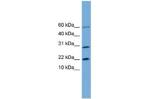 WB Suggested Anti-PRR13  Antibody Titration: 0. (Proline Rich 13 antibody  (N-Term))