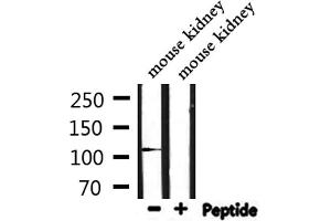 Western blot analysis of extracts from mouse kidney, using IGHMBP2 Antibody. (IGHMBP2 antibody  (Internal Region))