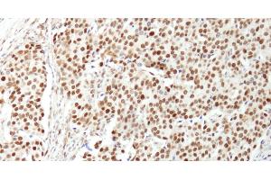 Immunohistochemistry (IHC) image for anti-Nuclear Casein Kinase and Cyclin-Dependent Kinase Substrate 1 (NUCKS1) (AA 1-50) antibody (ABIN7454407)