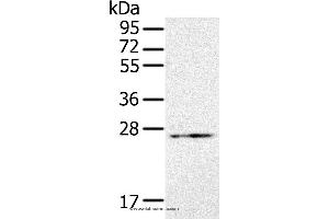 Western blot analysis of Jurkat cell, using RAB21 Polyclonal Antibody at dilution of 1:200 (RAB21 antibody)