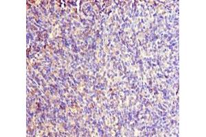 Immunohistochemistry of paraffin-embedded human thymus tissue using ABIN7167019 at dilution of 1:100 (RACGAP1 antibody  (AA 353-632))