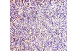 Immunohistochemistry of paraffin-embedded human thymus tissue using ABIN7167019 at dilution of 1:100 (RACGAP1 antibody  (AA 353-632))