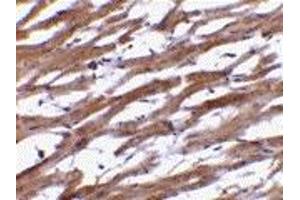 Immunohistochemistry (IHC) image for anti-B-Cell Receptor-Associated Protein 29 (BCAP29) (Middle Region) antibody (ABIN1030880) (BCAP29 antibody  (Middle Region))