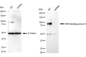 Western blotting analysis using RAN binding protein 9 antibody (ABIN7799025).