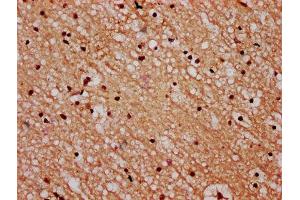 IHC image of ABIN7168574 diluted at 1:600 and staining in paraffin-embedded human brain tissue performed on a Leica BondTM system. (STH antibody  (AA 1-128))