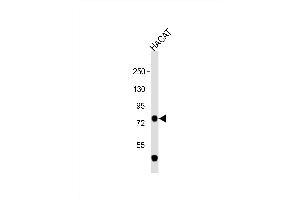 Anti-TP63 Antibody (C-term) at 1:1000 dilution + HACAT whole cell lysate Lysates/proteins at 20 μg per lane. (p63 antibody  (C-Term))