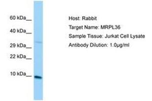 Image no. 1 for anti-BRCA1 Interacting Protein C-terminal Helicase 1 (BRIP1) (C-Term) antibody (ABIN6750116)