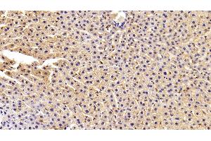 Detection of FASN in Rat Liver Tissue using Polyclonal Antibody to Fatty Acid Synthase (FASN) (Fatty Acid Synthase antibody  (AA 2263-2512))