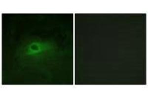 Immunofluorescence analysis of HeLa cells, using CSFR (Ab-809) antibody. (CSF1R antibody  (Tyr809))