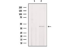 CHST13 antibody  (Internal Region)