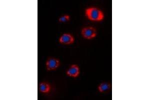 Immunofluorescent analysis of RPS12 staining in Hela cells. (RPS12 antibody  (C-Term))