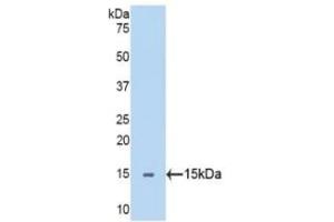 Detection of Recombinant SEMA5B, Human using Polyclonal Antibody to Semaphorin 5B (SEMA5B) (SEMA5B antibody  (AA 36-161))