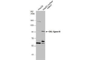 WB Image HepG2 whole cell and nuclear extracts (30 μg) were separated by 7. (LIG3 antibody  (C-Term))