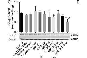 Western Blotting (WB) image for anti-Inhibitor of kappa Light Polypeptide Gene Enhancer in B-Cells, Kinase beta (IKBKB) (AA 630-730) antibody (ABIN3022876)