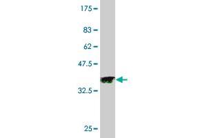 Western Blot detection against Immunogen (35. (PAK3 antibody  (AA 1-90))