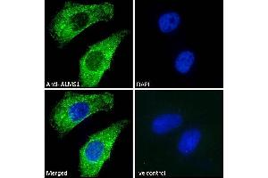 (ABIN184952) Immunofluorescence analysis of paraformaldehyde fixed HeLa cells, permeabilized with 0. (ALMS1 antibody  (C-Term))