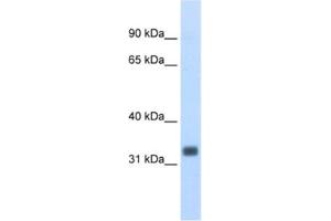 Western Blotting (WB) image for anti-Ets Homologous Factor (EHF) antibody (ABIN2462031) (EHF antibody)