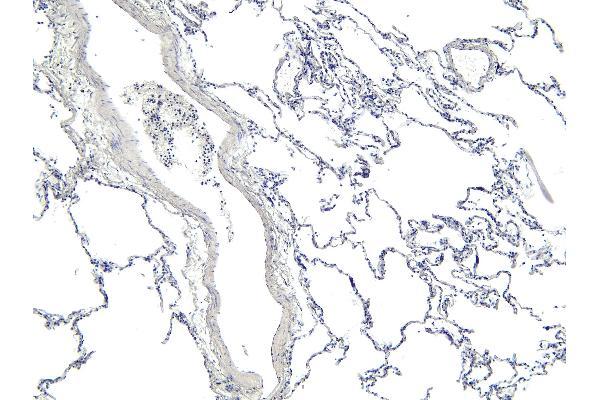 ARAP1 antibody  (C-Term)