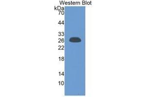 WB of Protein Standard: different control antibodies against Highly purified E. (CRP CLIA Kit)