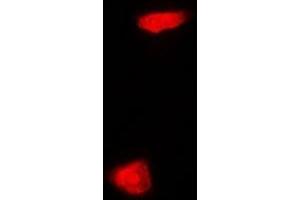 Immunofluorescent analysis of PHYHD1 staining in MCF7 cells. (PHYHD1 antibody)
