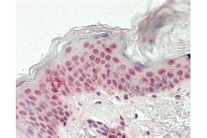 Human Skin: Formalin-Fixed, Paraffin-Embedded (FFPE) (MLL2 antibody  (AA 1487-1587))