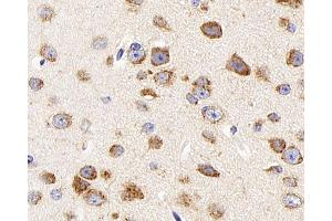 Immunohistochemistry analysis of paraffin-embedded mouse brain using DCX Polyclonal Antibody at dilution of 1:400. (Doublecortin antibody)