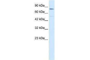 Human HepG2; WB Suggested Anti-ZNF341 Antibody Titration: 0. (ZNF341 antibody  (Middle Region))