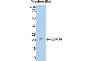 Detection of Recombinant IL18BP, Rat using Polyclonal Antibody to Interleukin 18 Binding Protein (IL18BP) (IL18BP antibody  (AA 29-193))