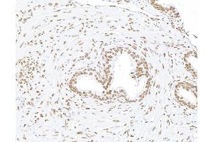 Immunohistochemistry (IHC) image for anti-Matrin 3 (MATR3) (C-Term) antibody (ABIN7455225) (MATR3 antibody  (C-Term))