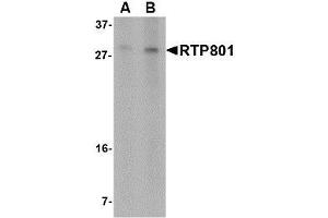 Image no. 1 for anti-DNA-Damage-Inducible Transcript 4 (DDIT4) (N-Term) antibody (ABIN1494371) (DDIT4 antibody  (N-Term))