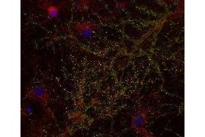 anti-Protein-Kinase, Interferon-Inducible Double Stranded RNA Dependent Inhibitor, Repressor of (p58 Repressor) (PRKRIR) (AA 720-775) antibody